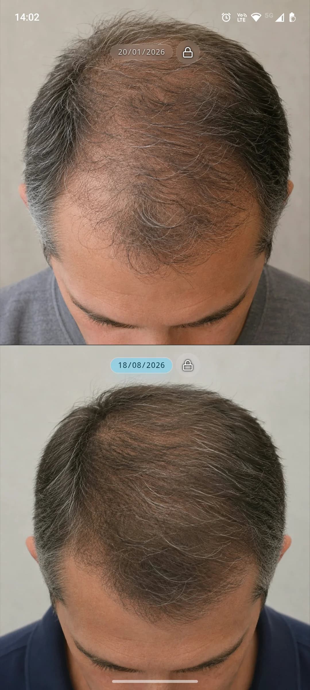 Before and after. Results the patient can see.