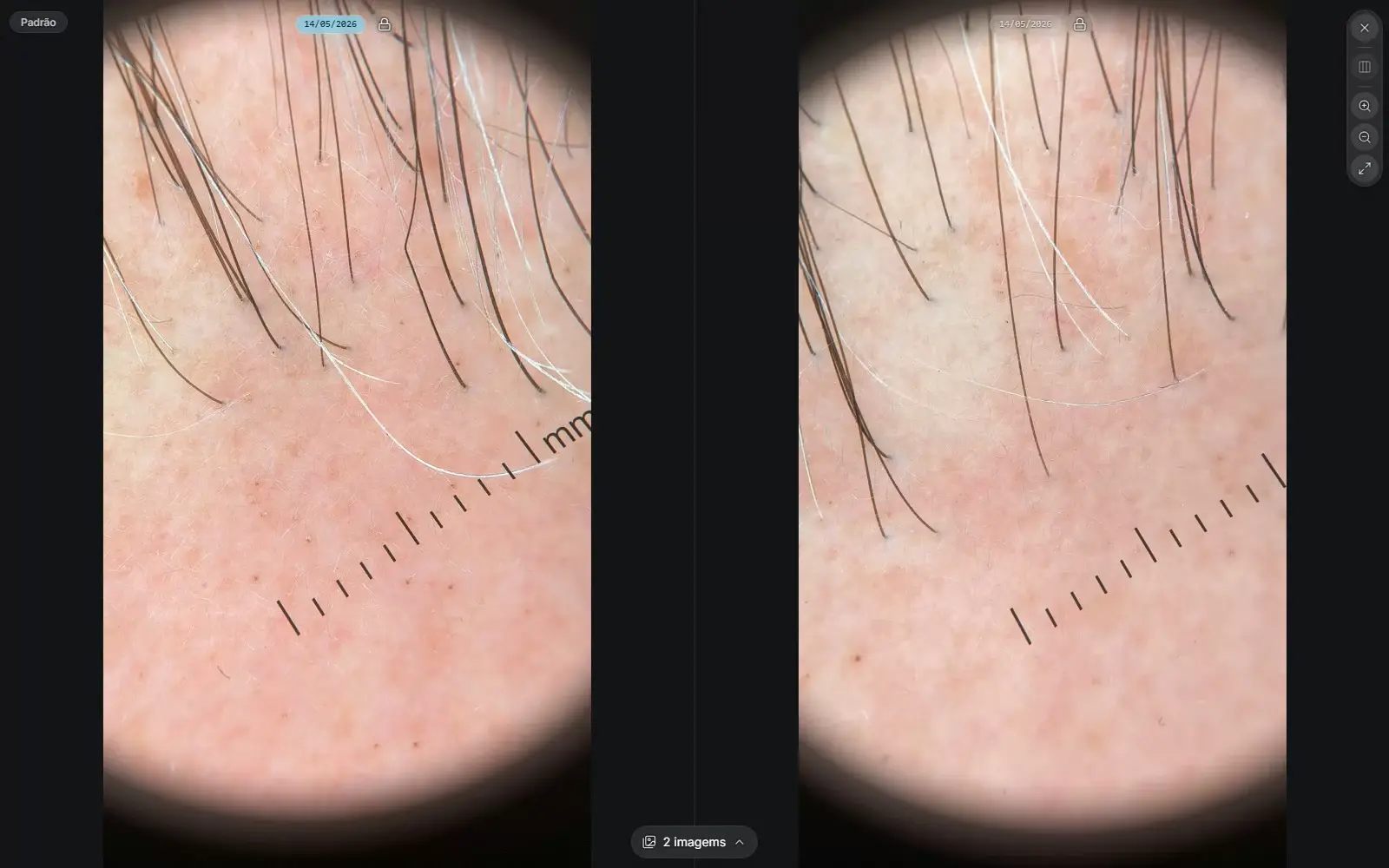 Side-by-side comparison of the same trail with synchronized zoom and pan